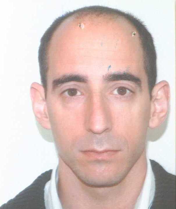 ד"ר עידו בן-צבי מומחה בנוירוכירורגיה